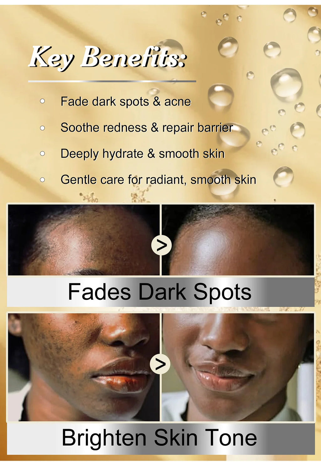 WK JALY Licorice Whitening Serum, Dark Spots Removal Essence, Brighten Skin Tone, Moisturizing, For Face, Body, 150ml