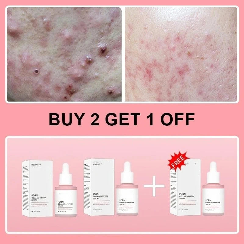 Collagen Peptide & PDRN Facial Serum