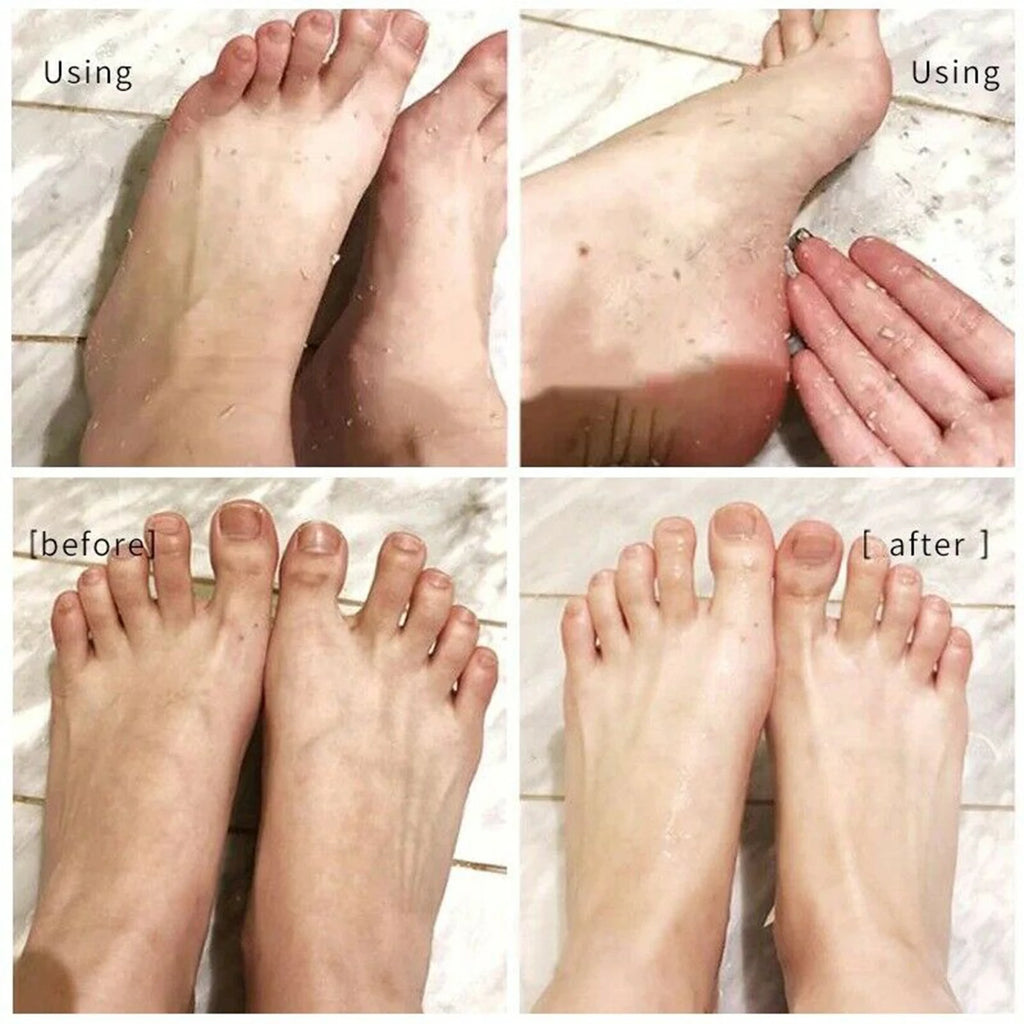 Foot Callus & Cuticle Softener – 110ml