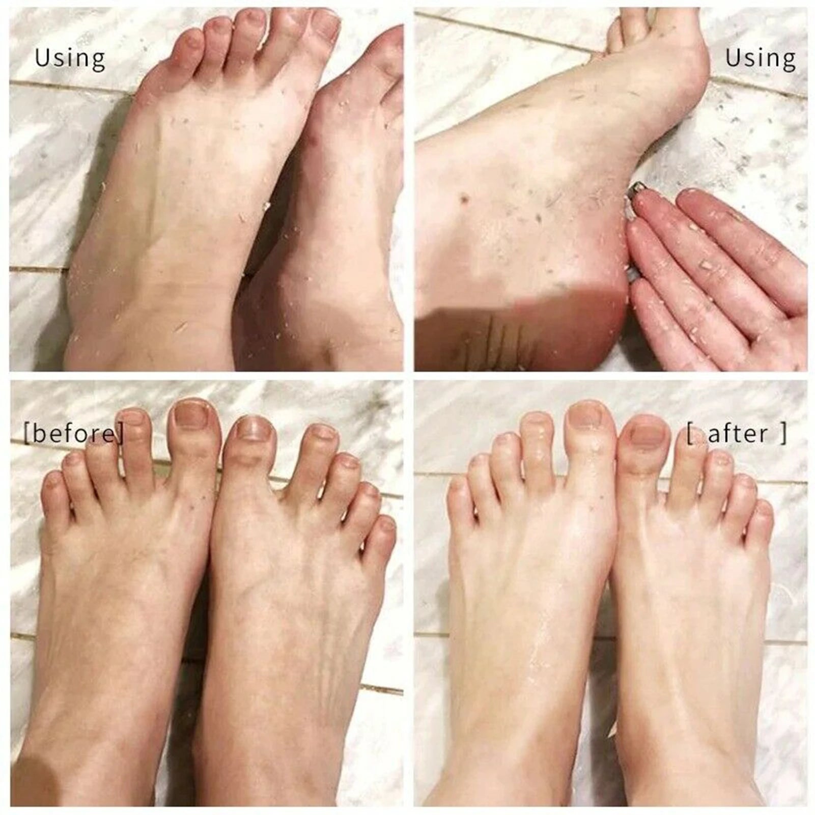 Foot Callus & Cuticle Softener – 110ml