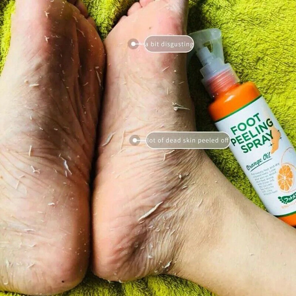 Foot Callus & Cuticle Softener – 110ml