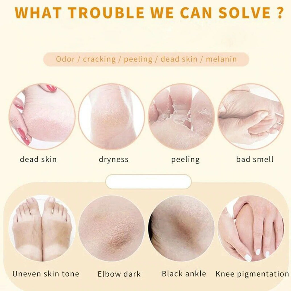 Foot Callus & Cuticle Softener – 110ml