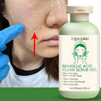Facial Exfoliating Gel – Deep Cleansing Scrub