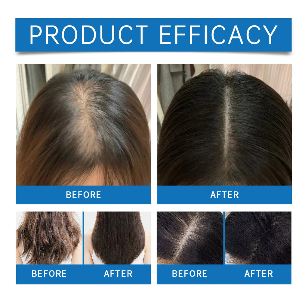 2026 latest technology new products Anti-hair Loss Essence Promotes Hair Growth and Improves The Scalp Environment
