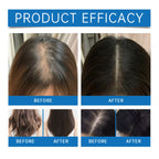 2026 latest technology new products Anti-hair Loss Essence Promotes Hair Growth and Improves The Scalp Environment