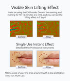 ANLAN Facial Massager Pro Microcurrent Face Lifting Skin Rejuvenation with Cold Deep Cleaning Anti-aging Skincare Beauty Device