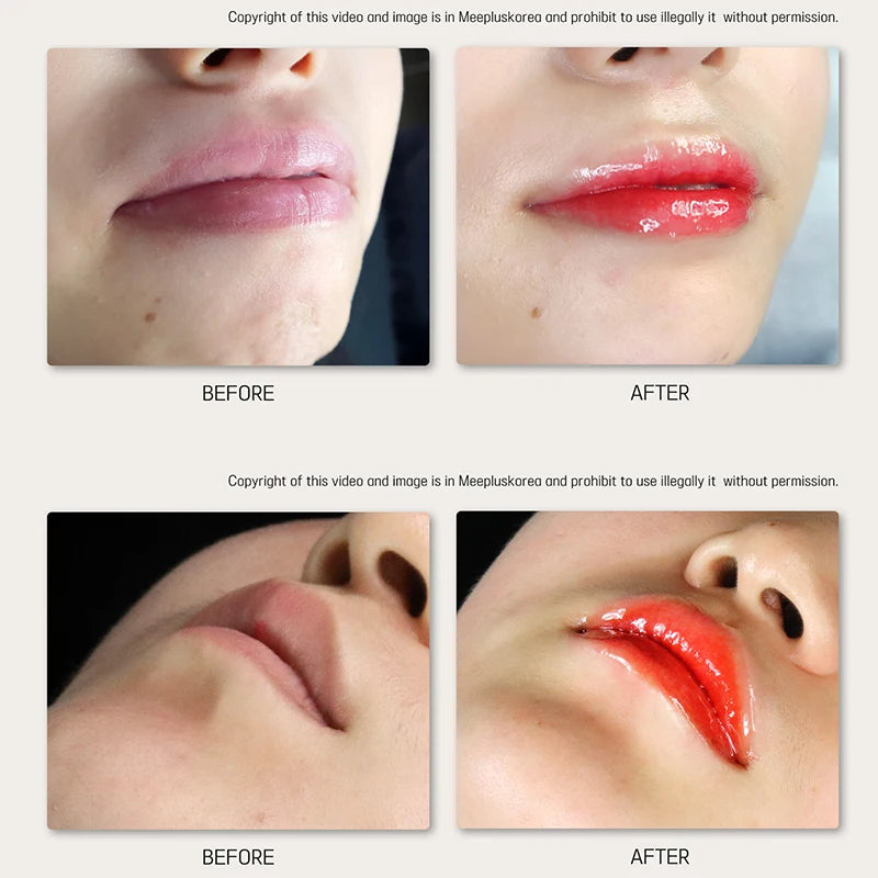 Korea 8ml BB Lips Cream Serum Starter Kit Persistent Colorfast Lip Gloss Pigment Moisturizing Lip Skin Care Treatment
