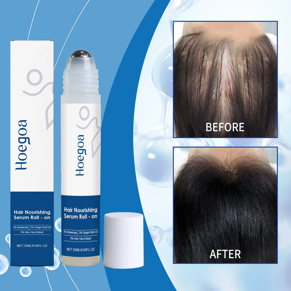 2026 latest technology new products Anti-hair Loss Essence Promotes Hair Growth and Improves The Scalp Environment