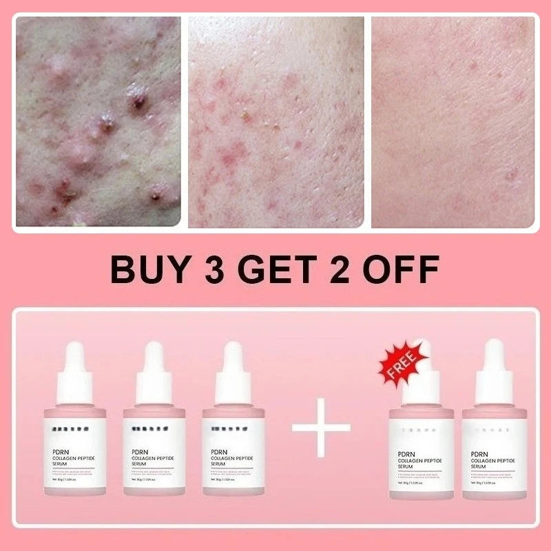 Collagen Peptide & PDRN Facial Serum