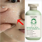 Facial Exfoliating Gel – Deep Cleansing Scrub
